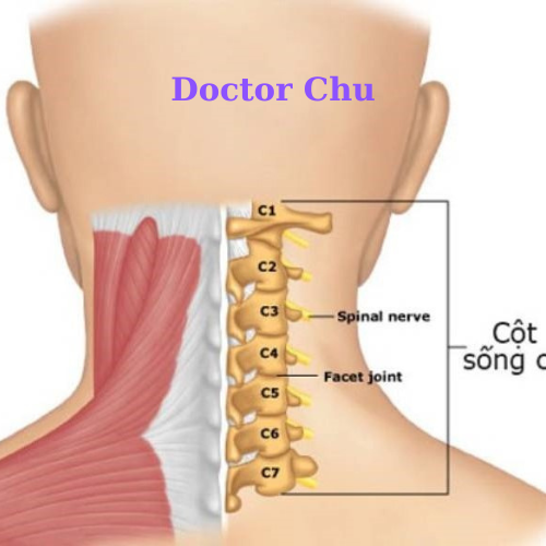 Chữa bệnh thoái hóa cột sống cổ bằng đắp nến paraffine như thế nào