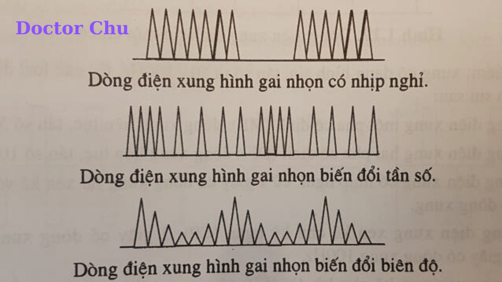 Dòng điện xungFaradic: Hình dạng xung động điện theo Doctor Chu