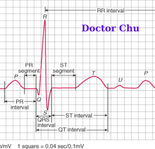 Phức bộ QRS trên điện tâm đồ Doctor Chu