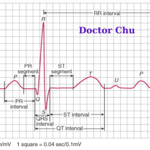 Phức bộ QRS trên điện tâm đồ Doctor Chu