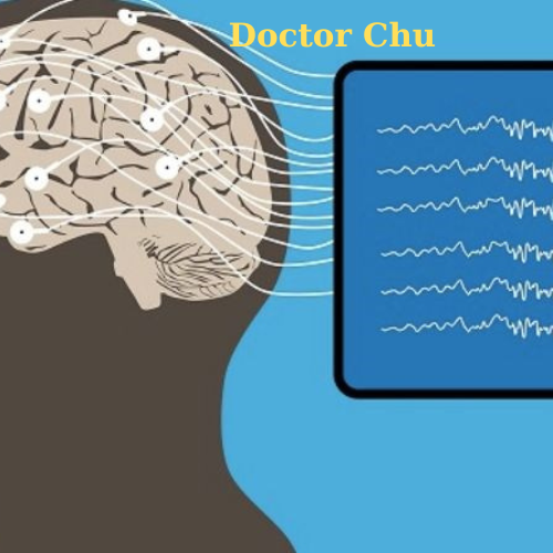 Điện não đồ học miễn phí theo Doctor Chu