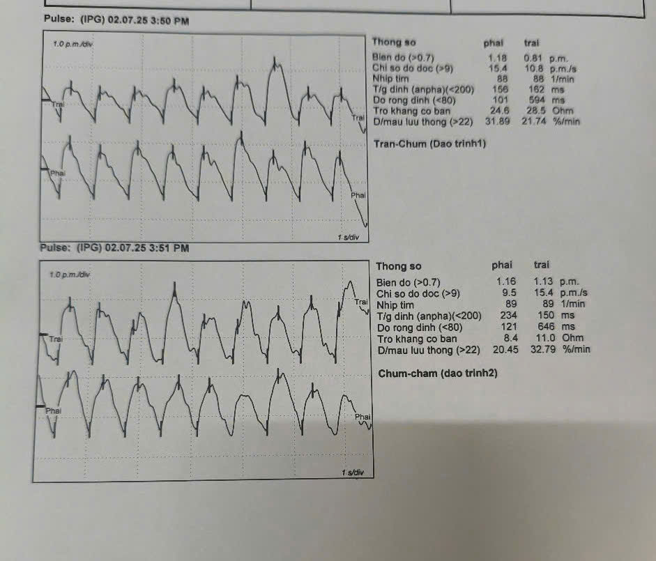 Lưu huyết não: Hướng dẫn đọc kết quả lưu huyết não bởi Doctor Chu