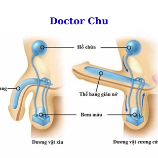 Doctor Chu rối loạn cương dương