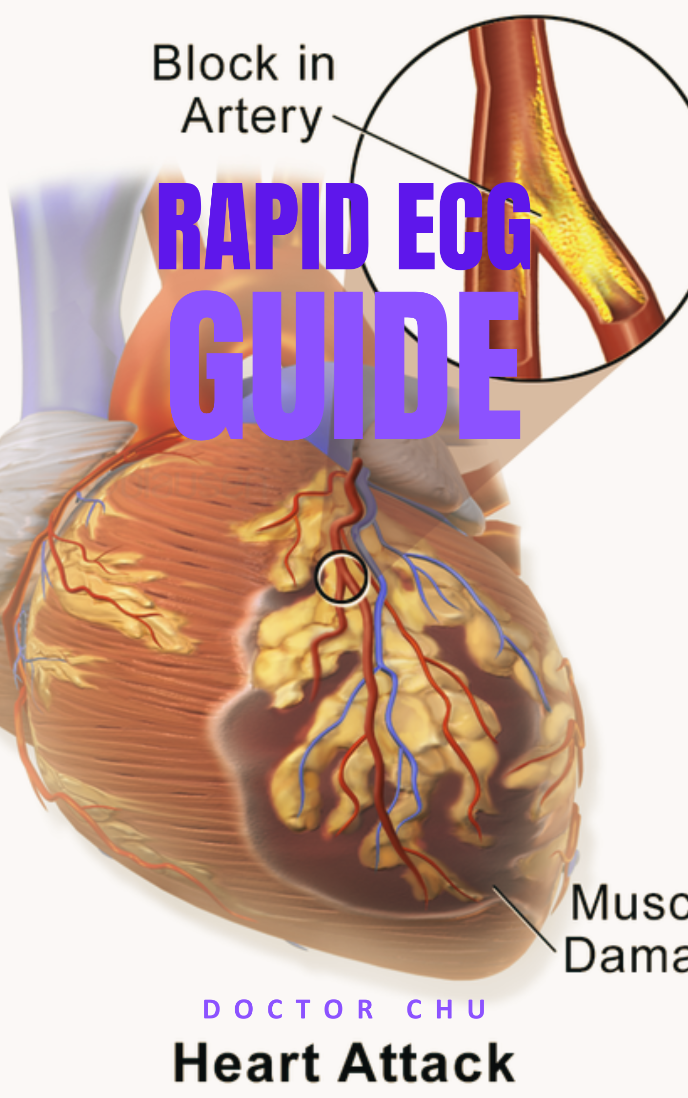 doctor chu update ECG 2025
