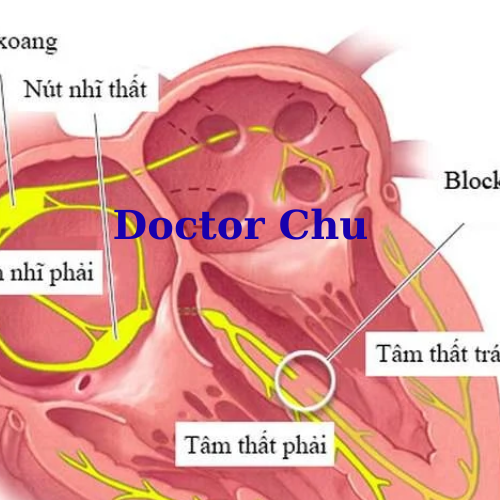 khóa học điện tâm đồ online 2025 do doctor chu tổ chức có gì mới