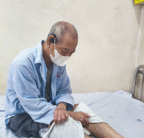 huong dan dieu tri bang paraffine